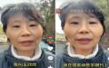 中国某三甲医院心外科手术医生王欣欣曝光医院惊人黑幕。（图片来源：视频截图）