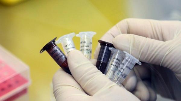 为防止武汉肺炎的传播,美国医生在使用机器人来治疗第一例确诊的武汉肺炎患者。示意图。(图片来源:STR/AFP/Getty Images )