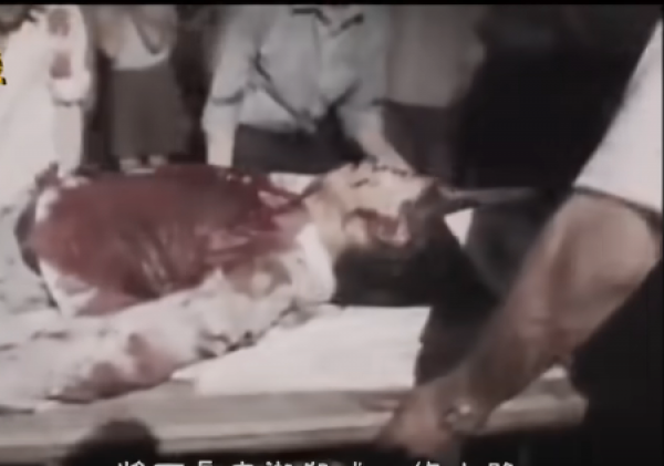 中弹伤者送往医院抢救。