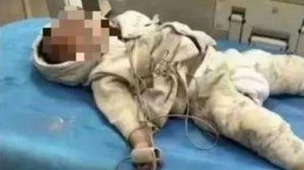 江苏1岁半婴儿不幸身亡。(图片来源:微博)