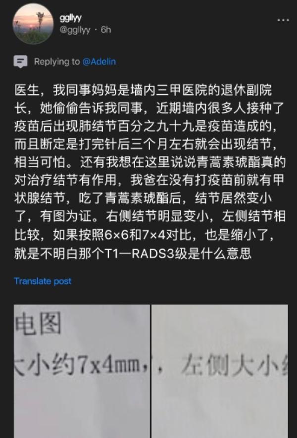 退休副院长:肺结节百分之99是疫苗造成的。(图片来源:网路截图)