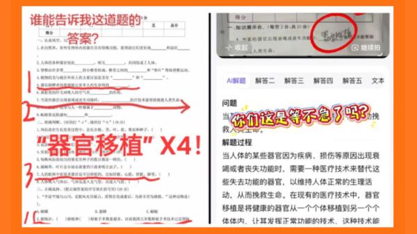 中国小学三年级科学试卷中，出现了几道与器官移植相关的题目。（图片来源：网络图片）
