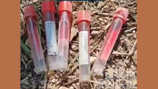 近日，中国山东枣庄市儿童福利院外发现多支病毒采样管。（图片来源：视频截图）